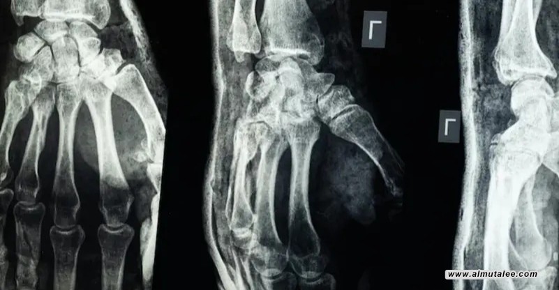 post-image