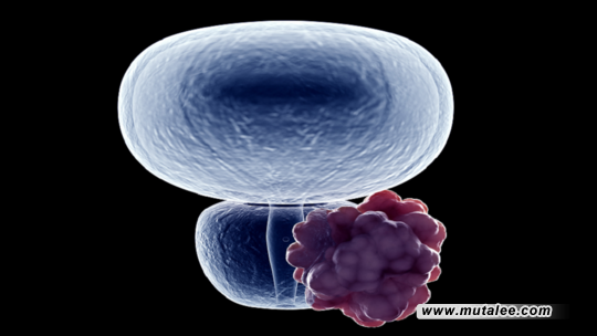 post-image